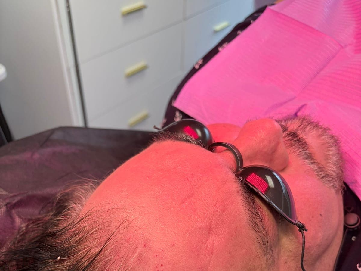 PikoPro 4 Laser Facial